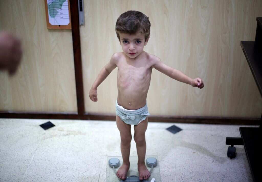 People afraid of infant death in Eastern Ghouta.