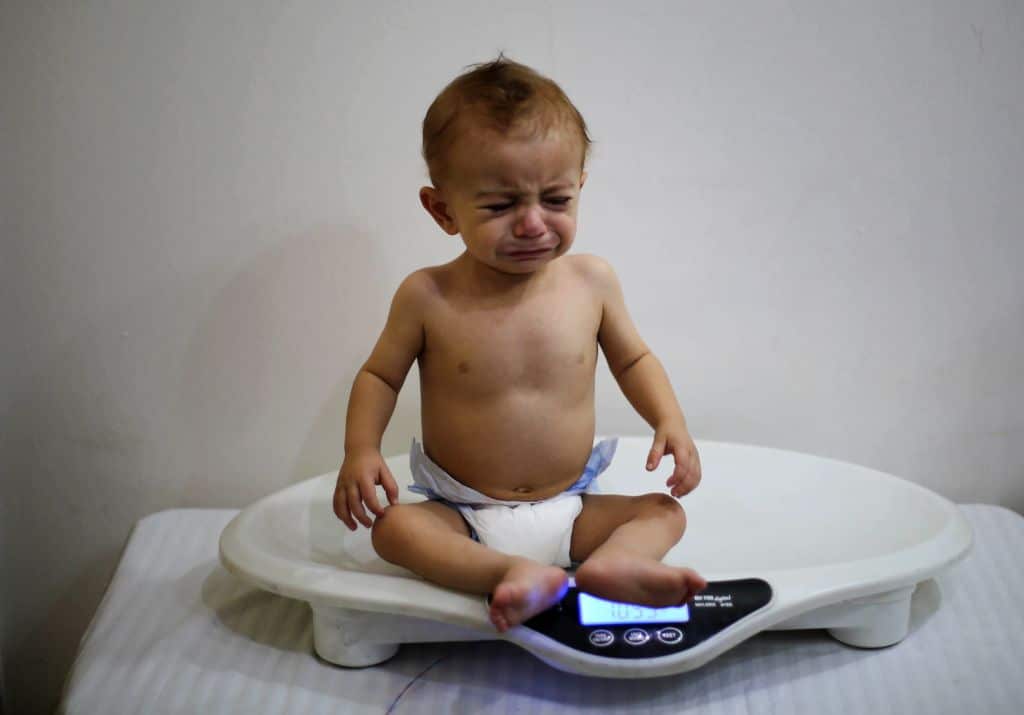 A baby is weighed in Eastern Ghouta. 