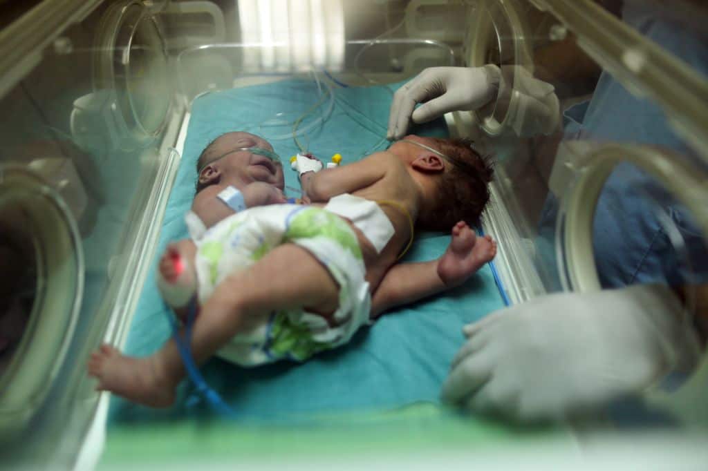 One-day-old Palestinian conjoined twins lie in an incubator at the nursery on October 22, 2017 at al-Shifa Hospital in Gaza City. / AFP PHOTO / MAHMUD HAMS        (Photo credit should read MAHMUD HAMS/AFP/Getty Images)