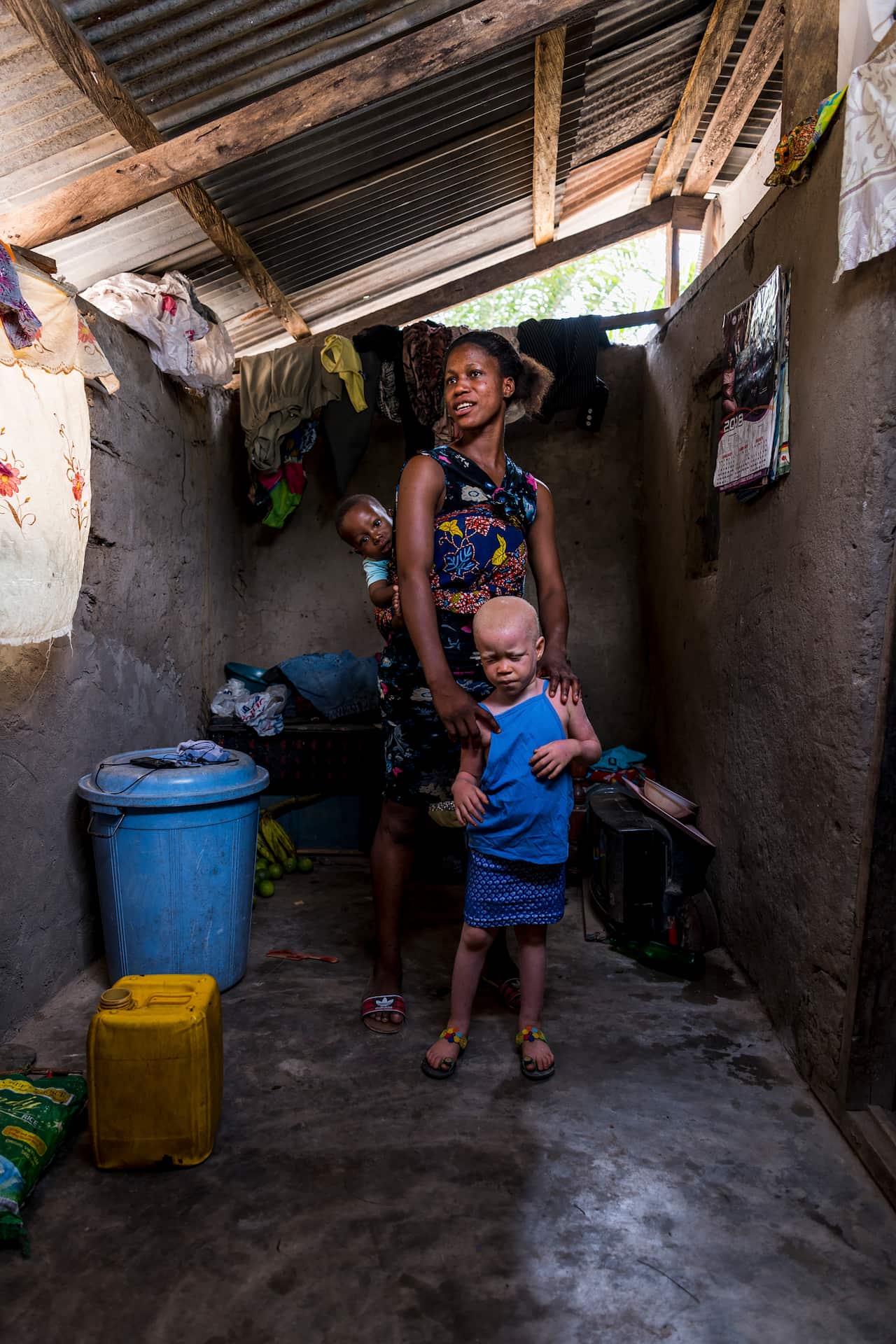 Nancy Darkoa and her daughter, Francisca Torsu, 4, who has albinism, in a remote village in the Koforidua region of Ghana.