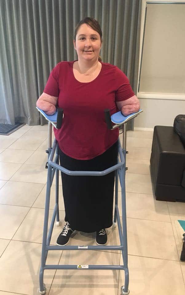 Korina Valentine adapting to live as a quad amputee after suffering from sepsis.