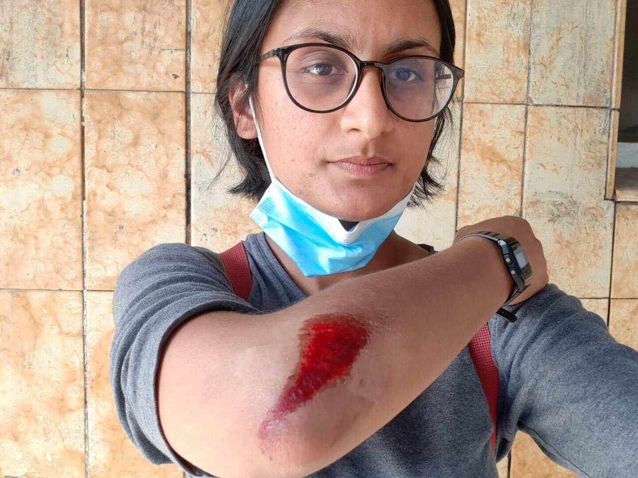 Shovan Bhattaraj recieved cuts and bruises after being thrown onto the pavement by police.
