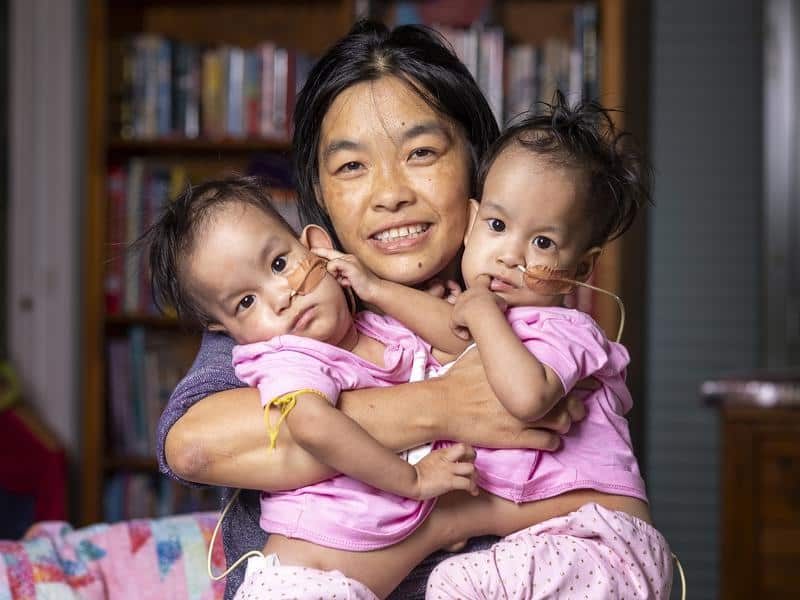 Bhumchu Zangmo with her conjoined twins Nima and Dawa.