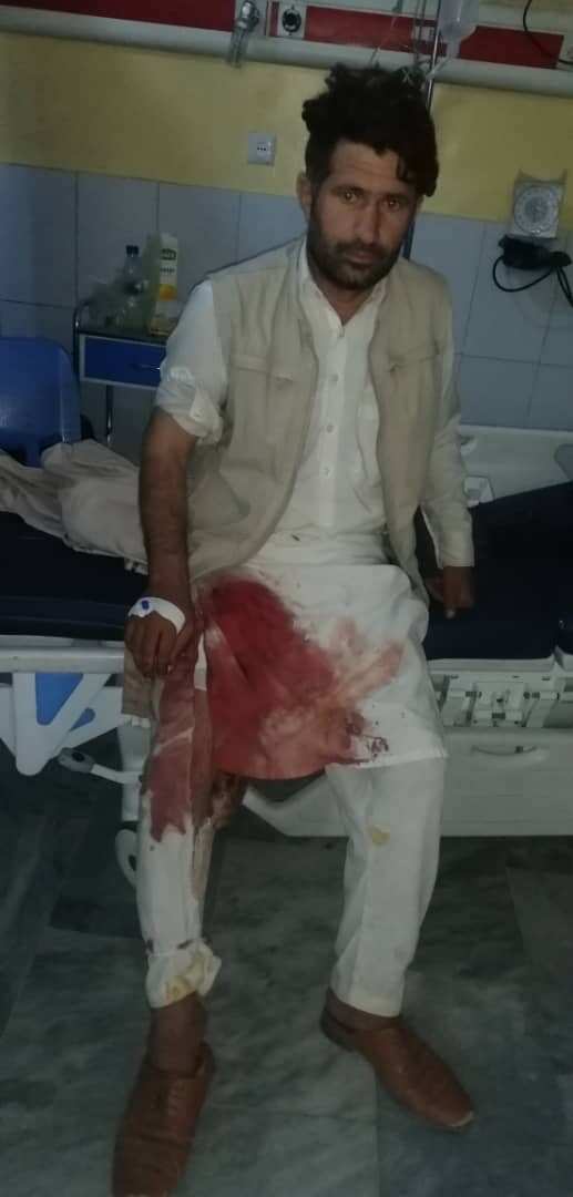Malik in hospital after sustaining a gunshot to his leg at Kabul airport
