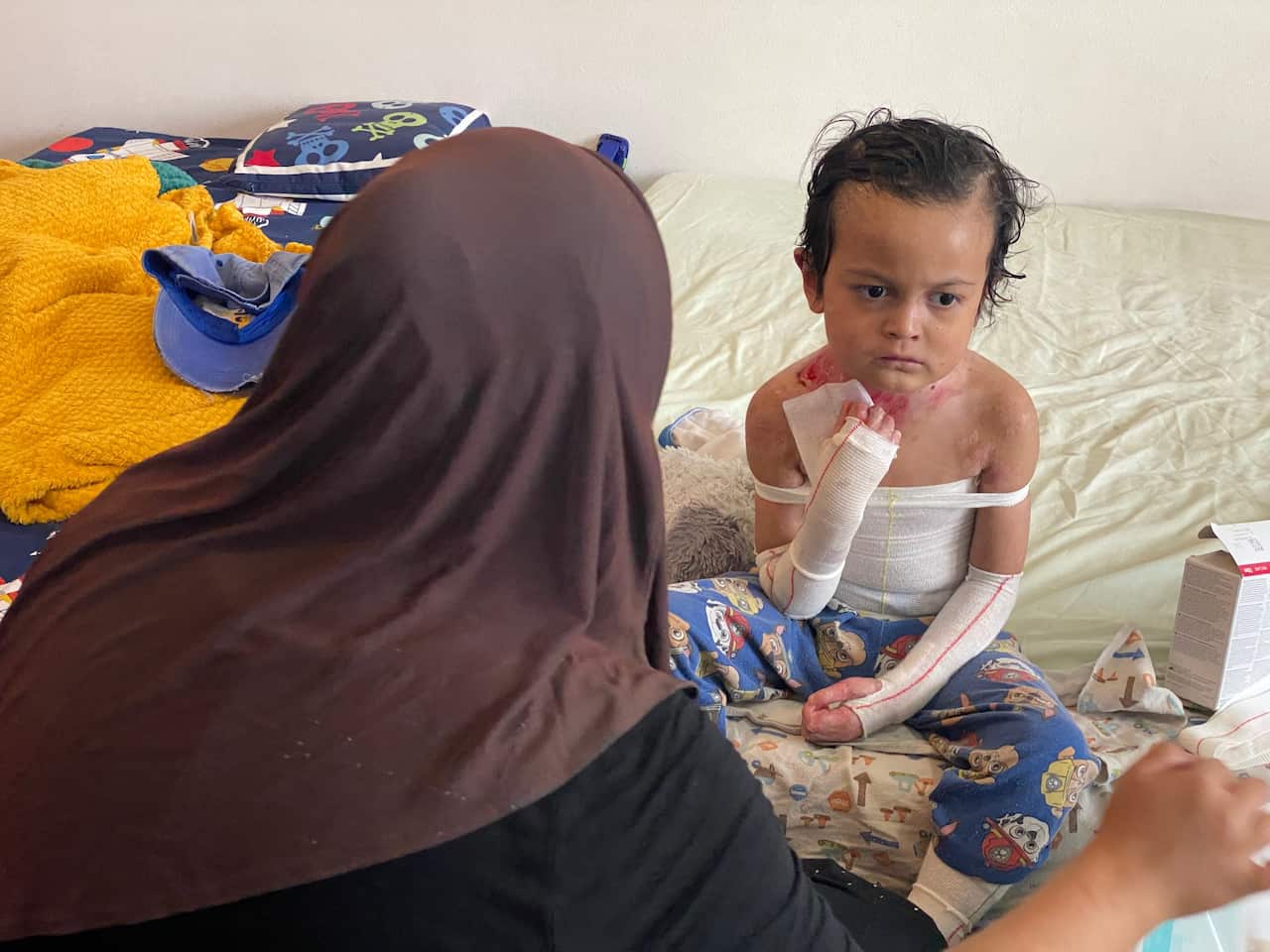 Muhammad Azraqee has blisters on 70 per cent of his body.