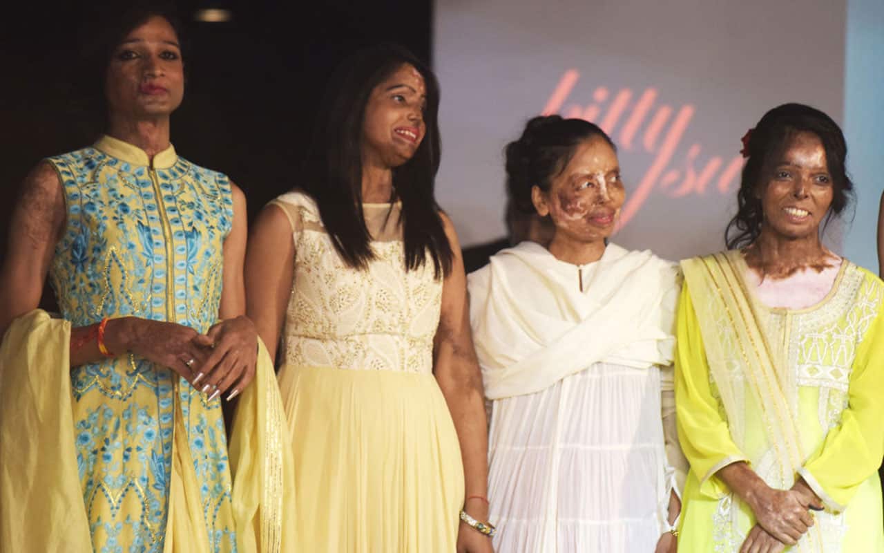 Indian acid attack survivors pose at the end of a fashion show organised by the 'Make Love Not Scars' NGO in New Delhi.