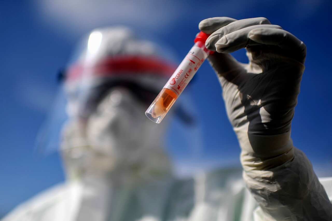 Doctor of the Giugliano Hospital show the test tube for people who have to carry out the test for the coronavirus COVID-19.