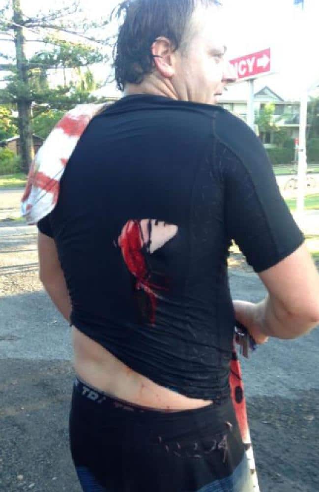 Jebez Reitman was attacked by a shark at Byron Bay in February 2015.