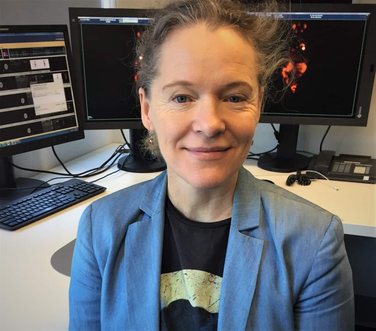 Professor Louise Emmett is supervising several prostate cancer trials.