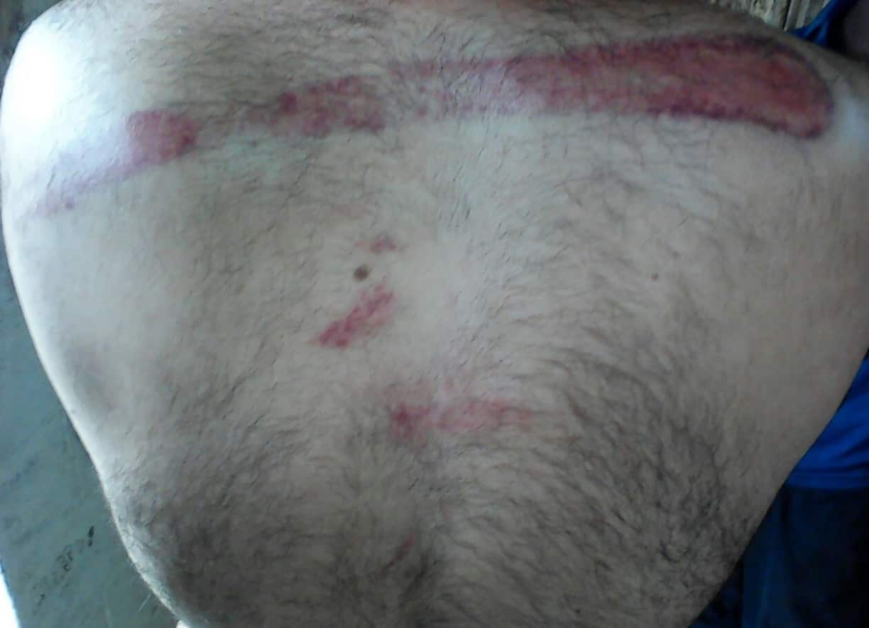 A supplied image obtained Sunday, Jan.01, 2017 of one of the two Iranian refugees on Manus Island who were reportedly bashed (AAP)