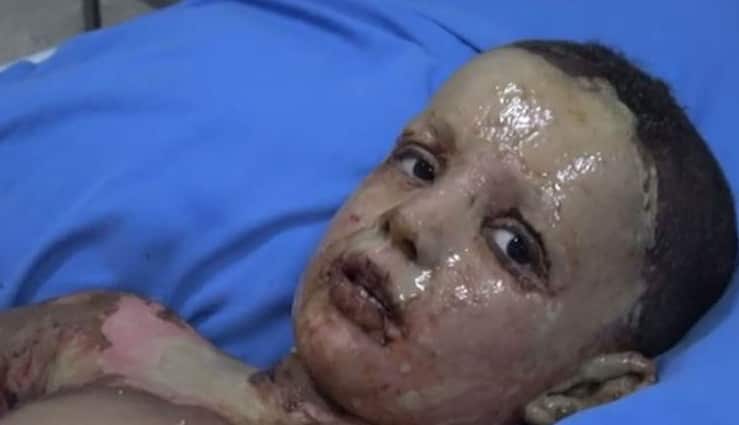 Kurdish sources have called for an investigation into the alleged uses of banned chemical weapons in Syria. 