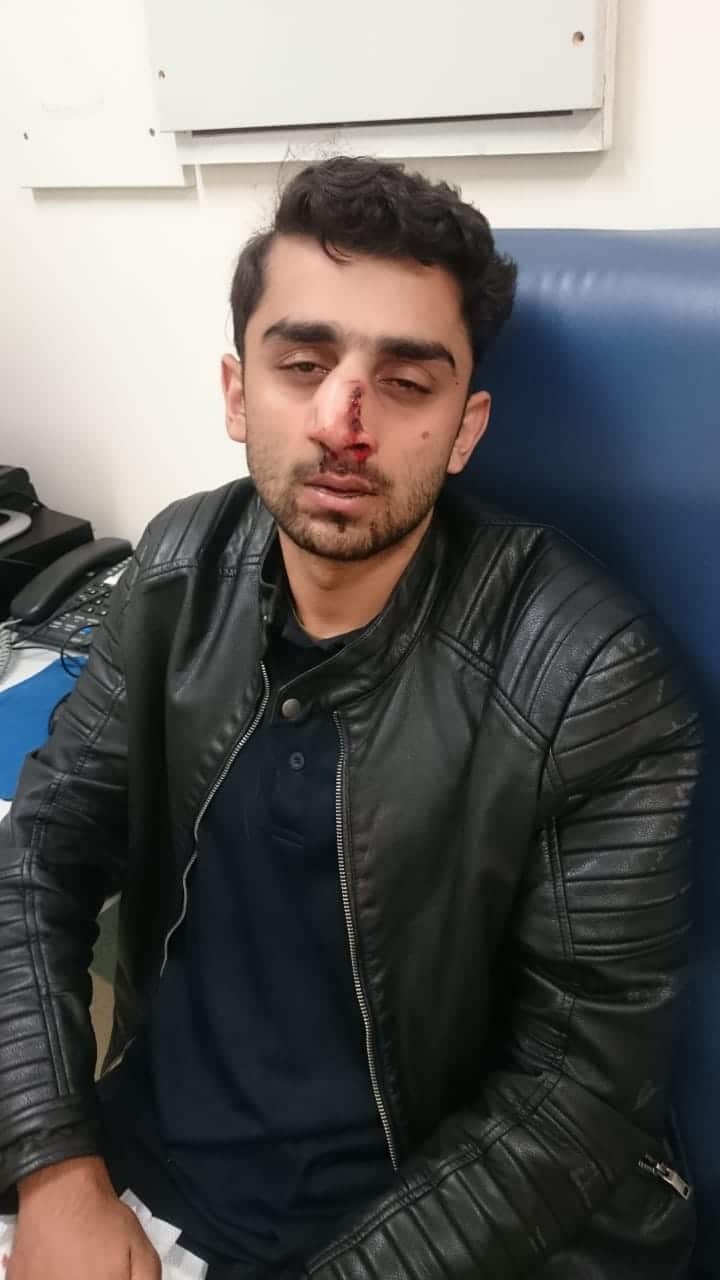 Abdullah Qaiser after he was attacked on campus.
