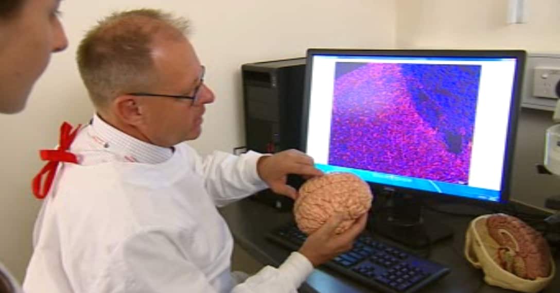 Professor Chris Sobey worked on the study.