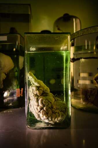 Animal brain in glass jar with formaldehyde in dark and creepy laboratory.