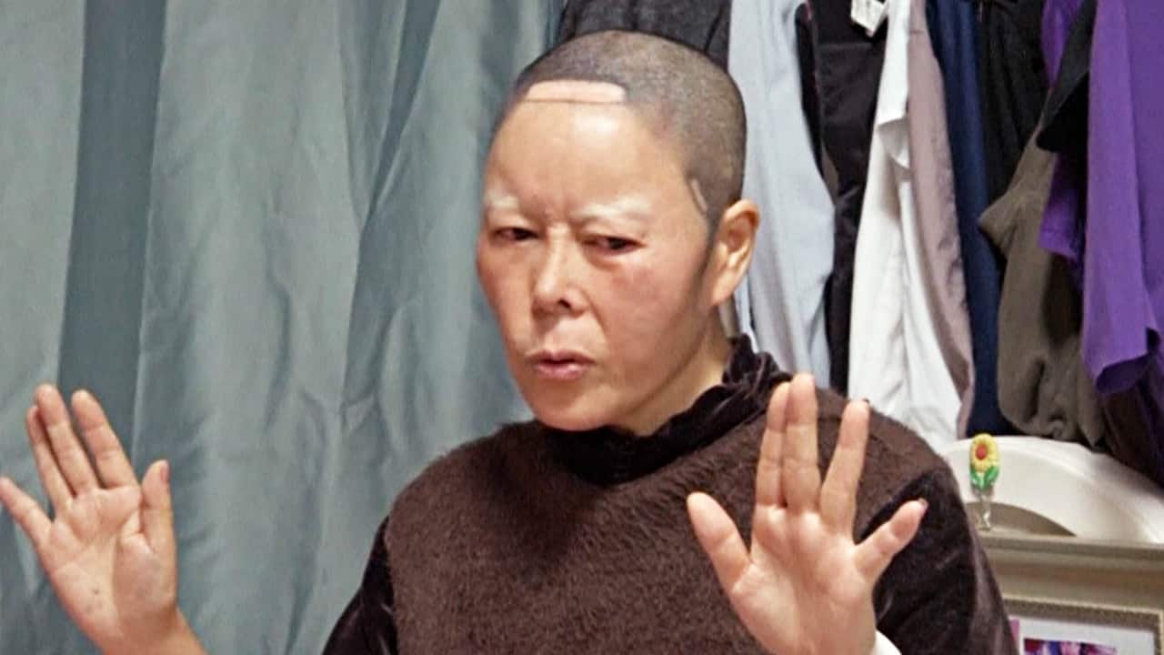South Korean botched plastic surgery patient Kim Bok-Soon. (Reuters)