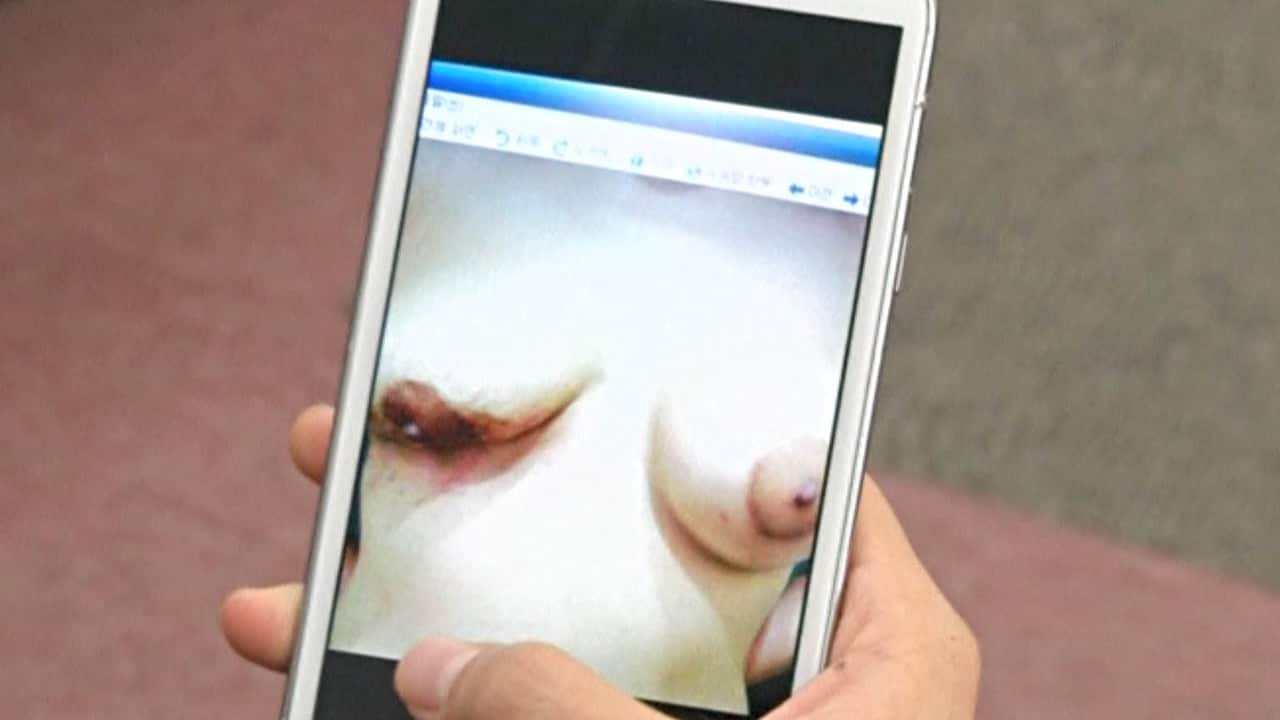 Ms Park's botched breast augmentation. (Reuters)