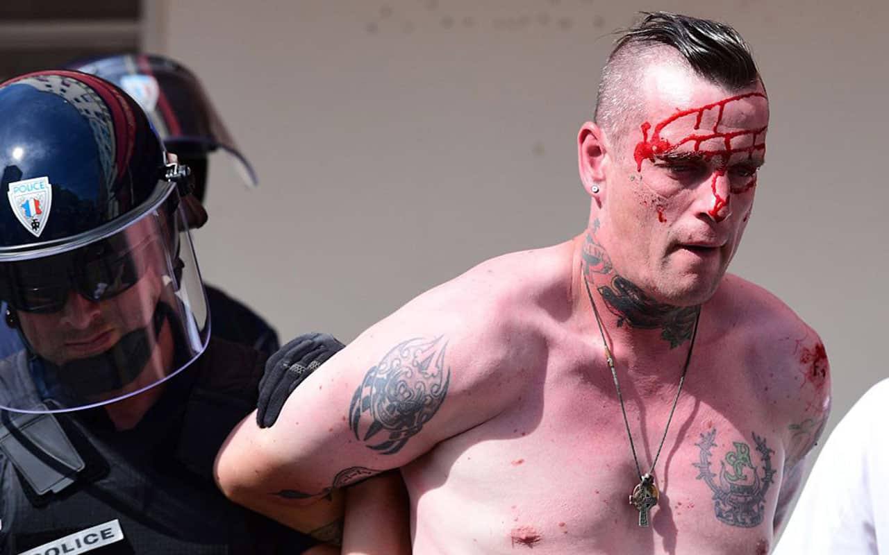 An injured England fan is detained by police ahead of the Euro 2016 football match between England and Russia.