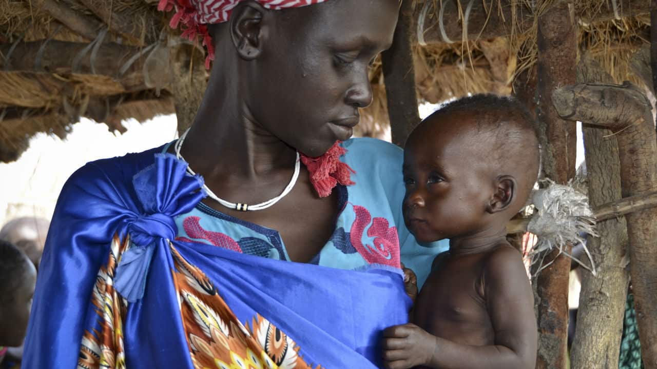 Elizabeth Nyakoda holds her severely malnourished 10-month old daughter at the feeding center for children in Jiech, Ayod County, South Sudan.
