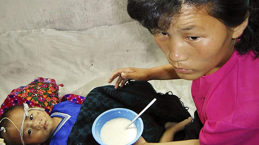 Millions of North Koreans are malnourished according to a new report.