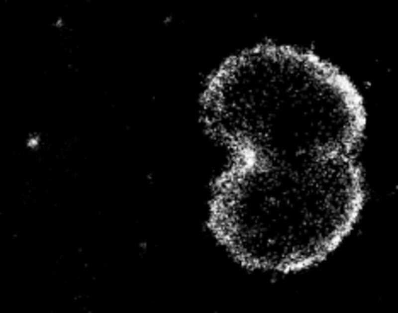 Australian doctors have developed a new test for patients with gonorrhoea. Pictured is the gonorrhoea-causing bacteria.