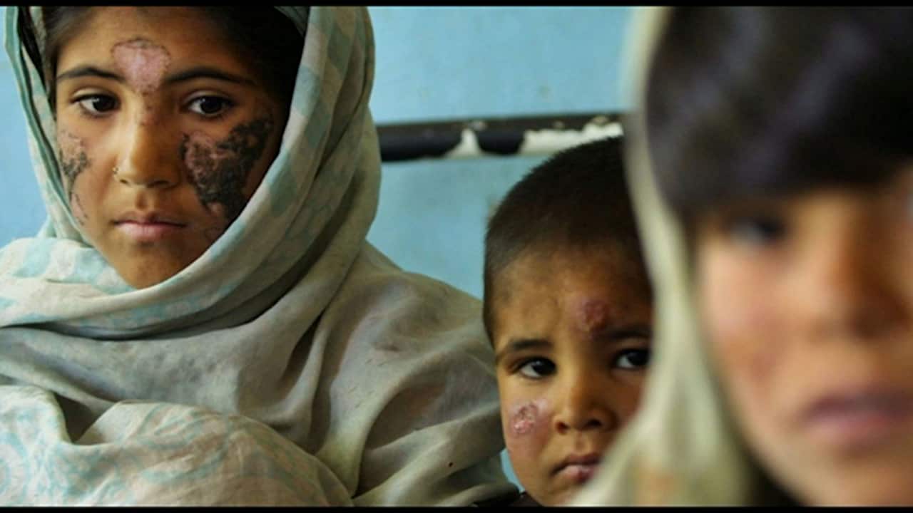 More that 1.3 million people are infected with the various forms of Leishmaniasis every year.