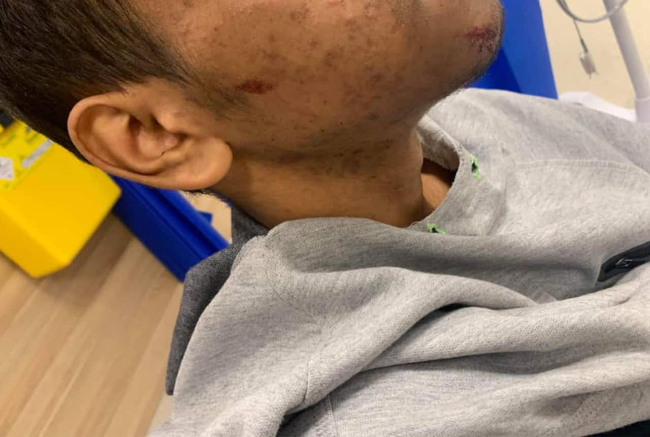 The teenager was taken to  St Vincent’s Hospital following the arrest. 