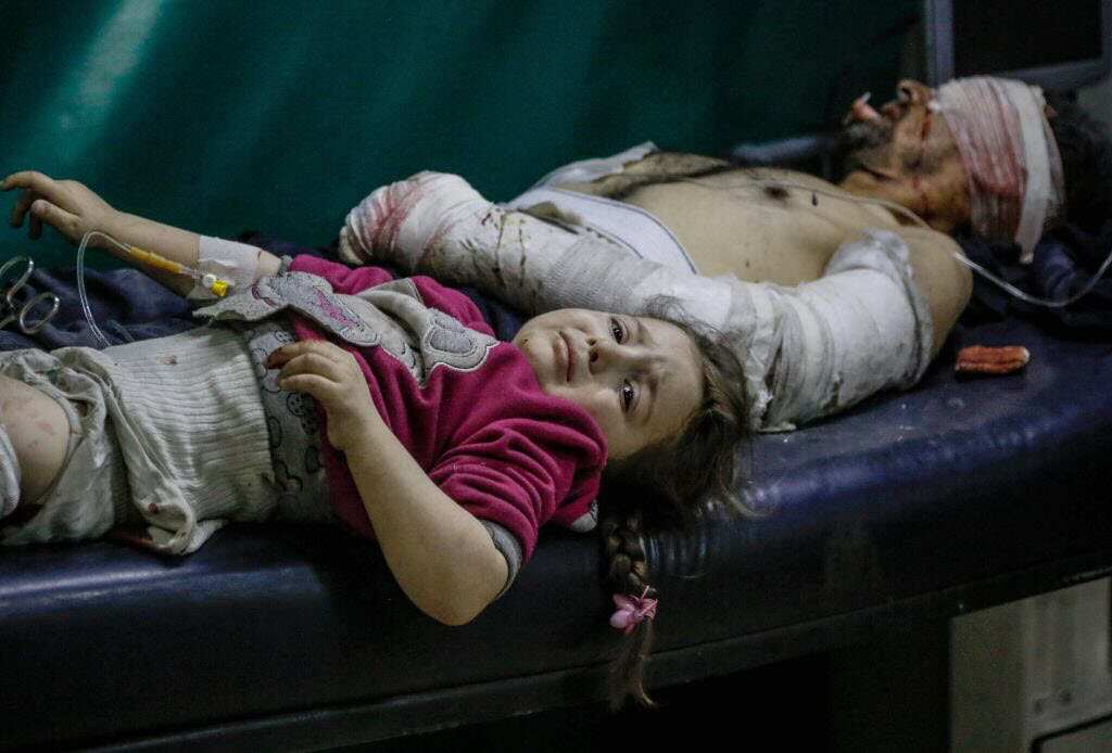 Syrians including children injured in Zamalka neighborhoods of the Eastern Ghouta region, receive medical treatment.