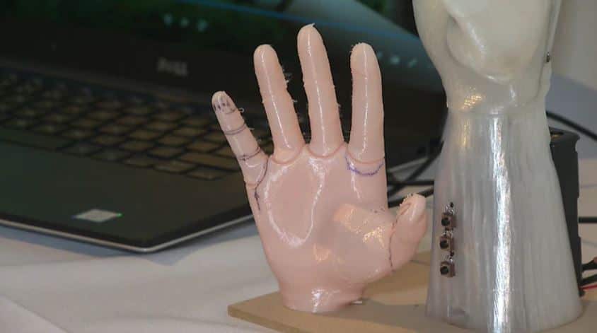 A bionic hand.