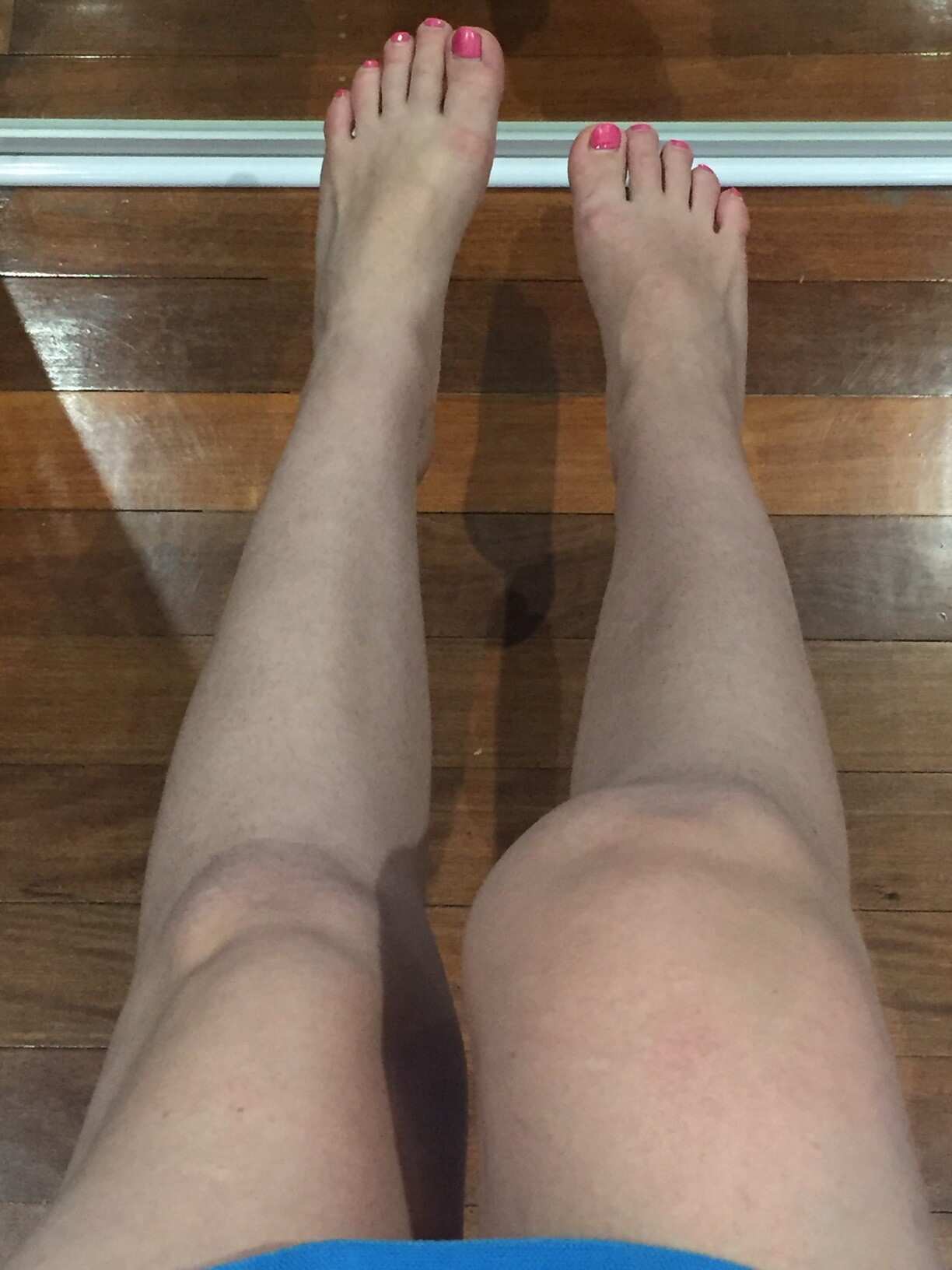 Knee