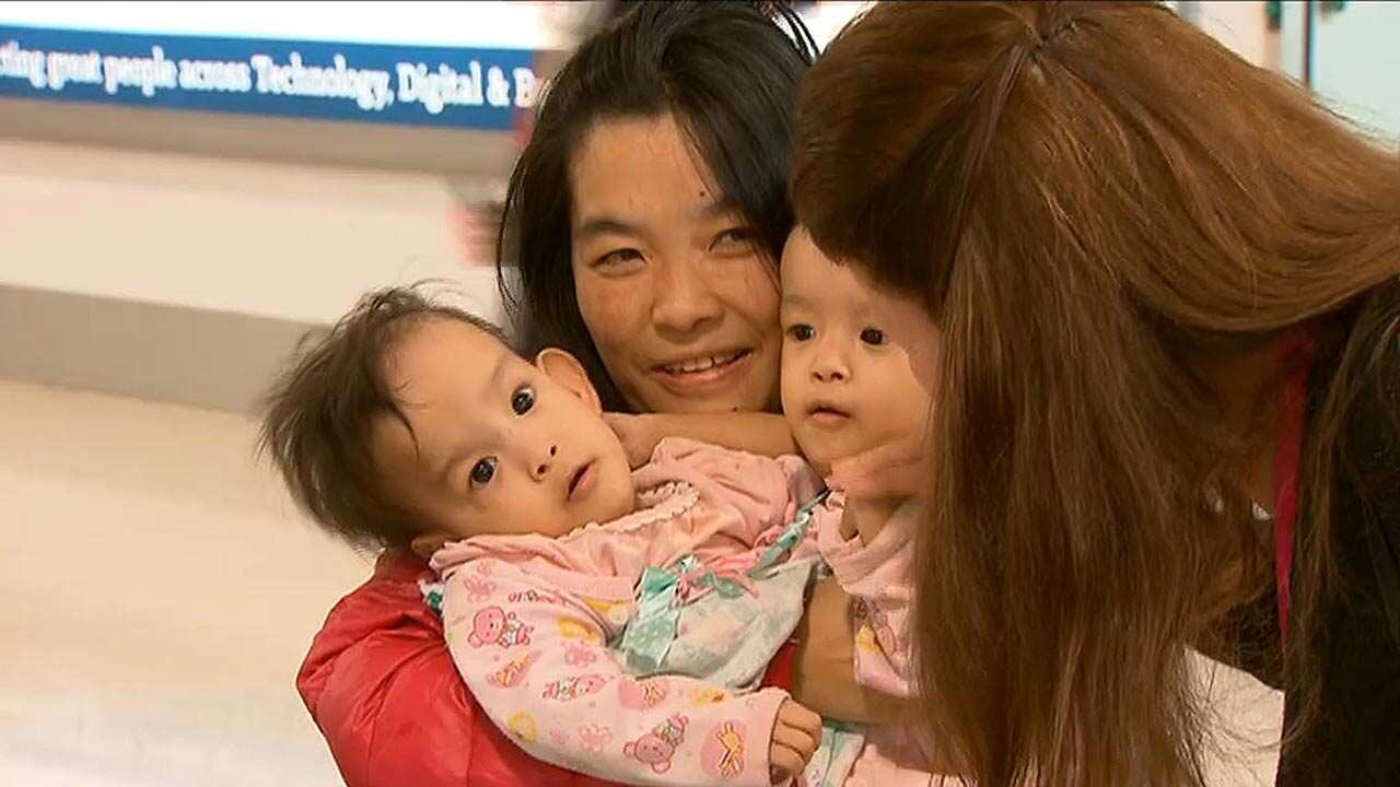 The conjoined 14-month-old twins have arrived in Melbourne from Bhutan.