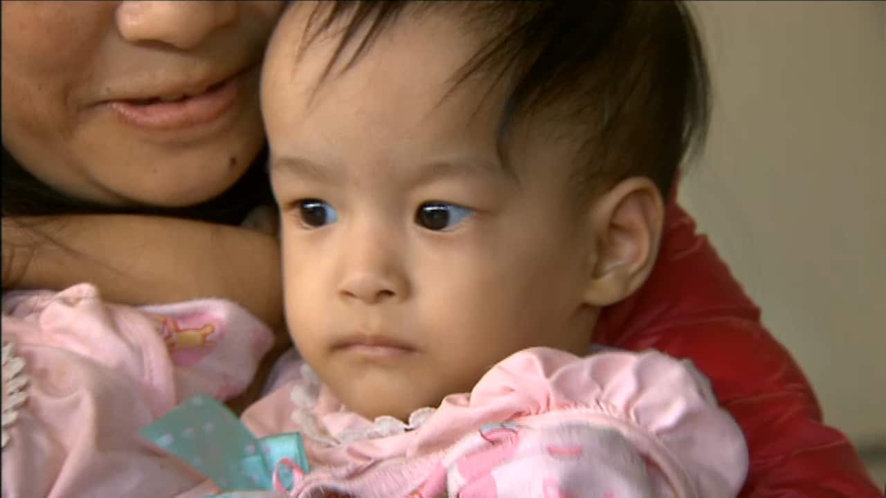 One of the conjoined twins in her mother's arms.