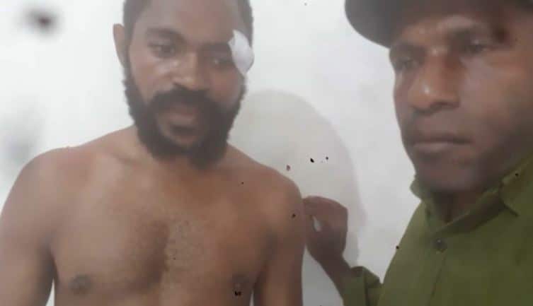 Andi Ogetai and Victor Yeimo. Mr Ogetai said militia pulled him and his companions out of a car and attacked them.