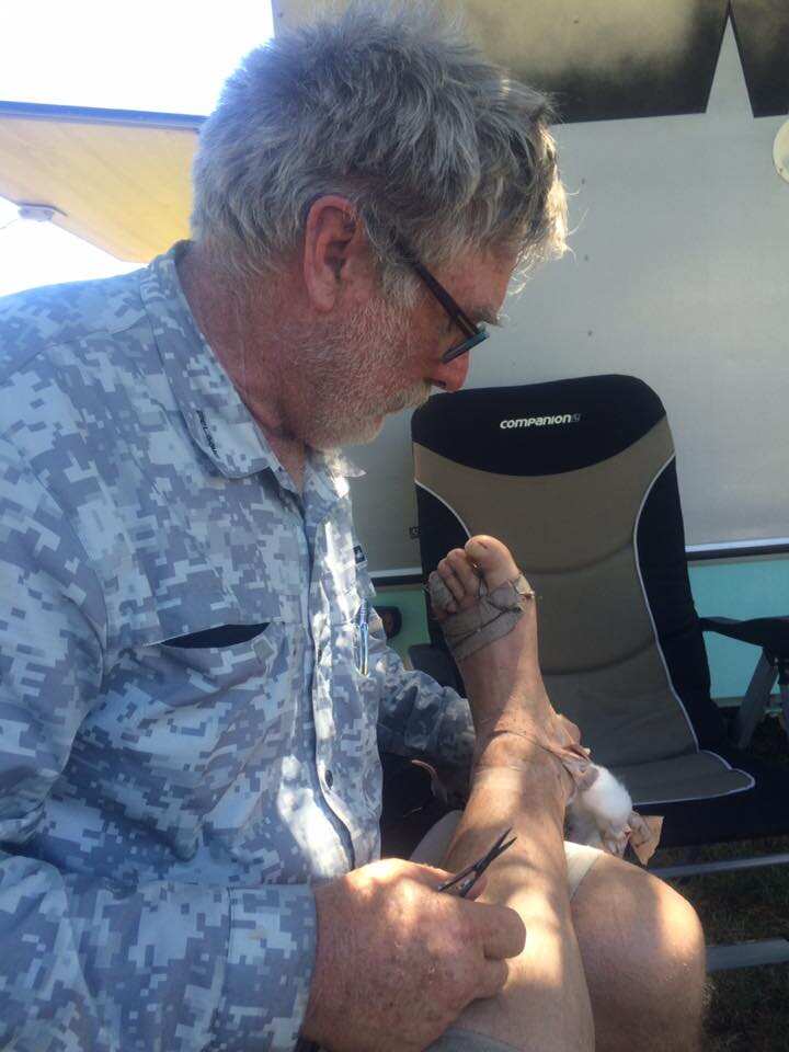 Pat Hill tends to Ned Richards' blistered feet.