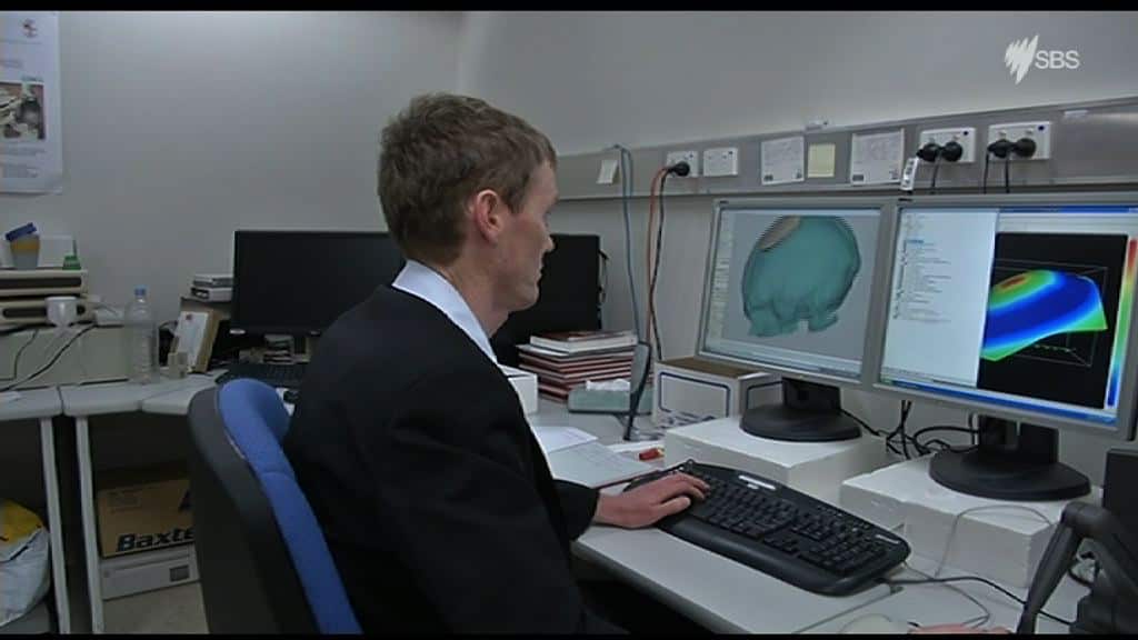 Doctors at Royal Perth Hospital hope to use 3D printing and stem cells to grow skull bones.