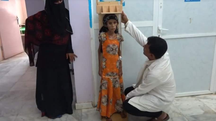 Fatima Qoba's slide into starvation is typical of what is happening in much of Yemen, according to the UN.
