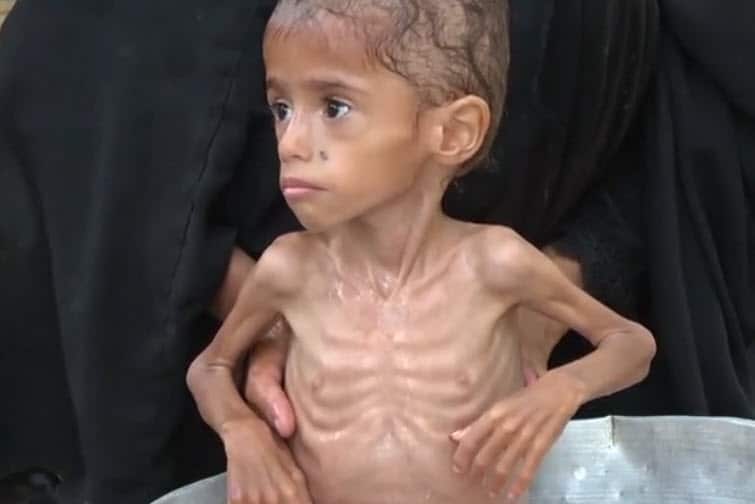yemen toddler