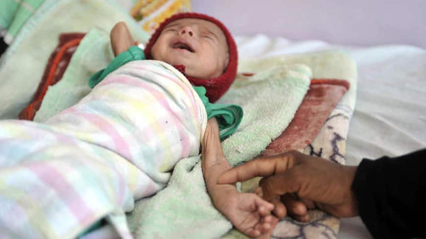 A malnourished Yemeni baby cries as he lies on a bed at a therapeutic feeding centre in al-Sabaen Hospital in Sana'a, Yemen.