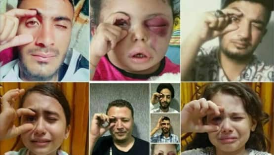 Social media users post photographs of themselves in the same pose with the hashtag “Buthaina” or “Picture Ur eye 4 Bothinah”.