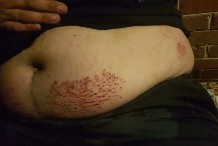 The teenager is awaiting the result of tests after the incident left him on the side of the road in convulsions. 