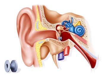 grommet, middle ear,