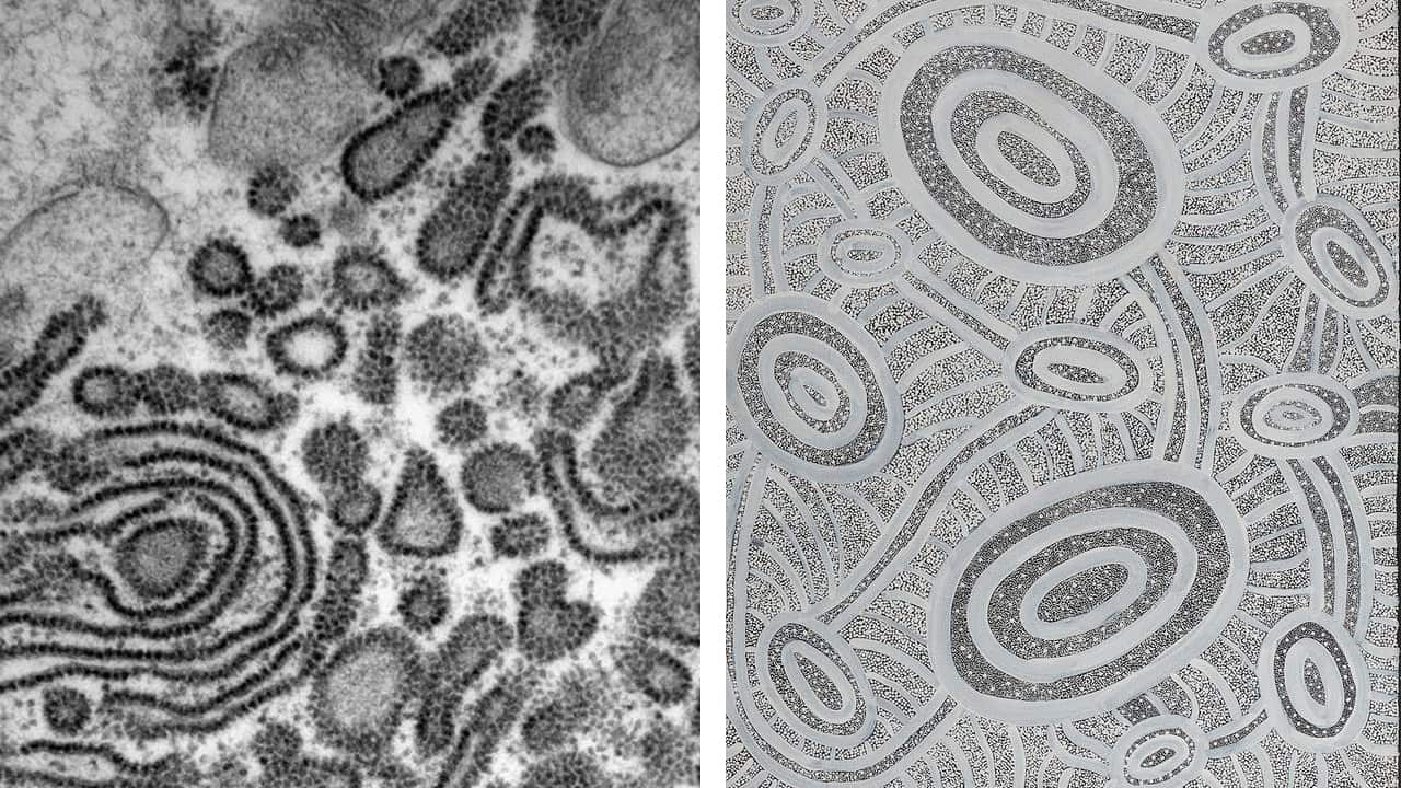 Ribosomes and Janganpa Jukurrpa.