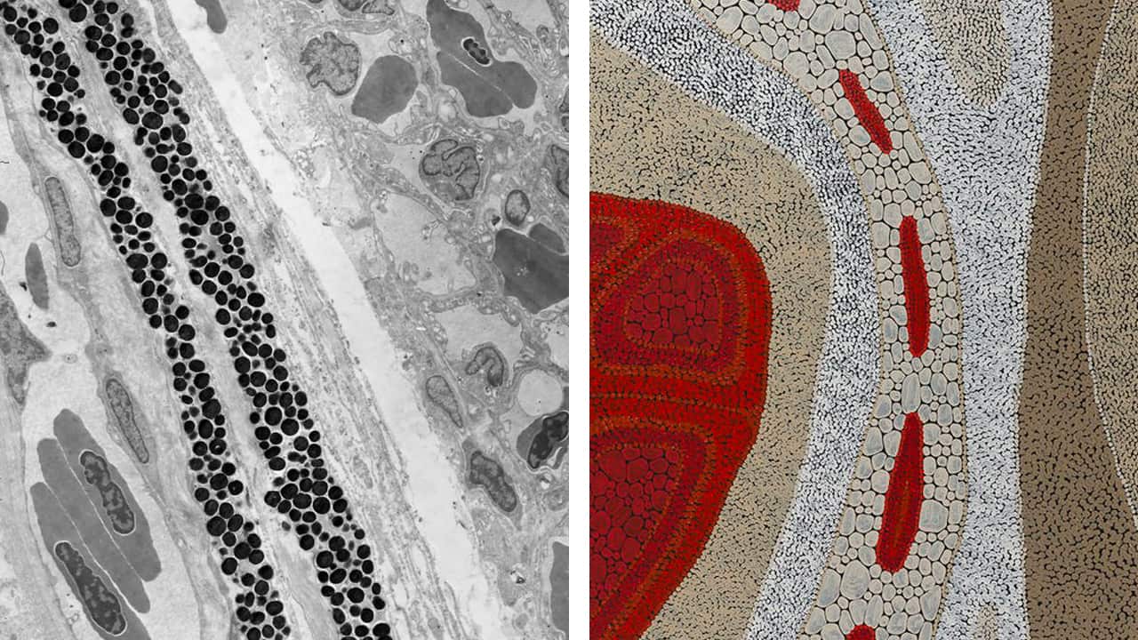 Fish Eye – Blood Flow and Dry River Bed.