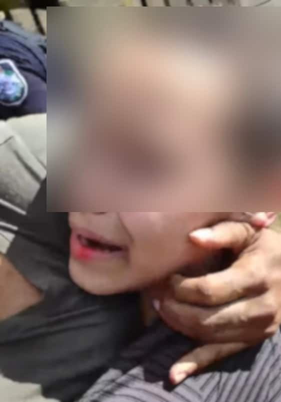 An Indigenous girl has a bloody lip after an altercation with Queensland Police, 8th August 2019.