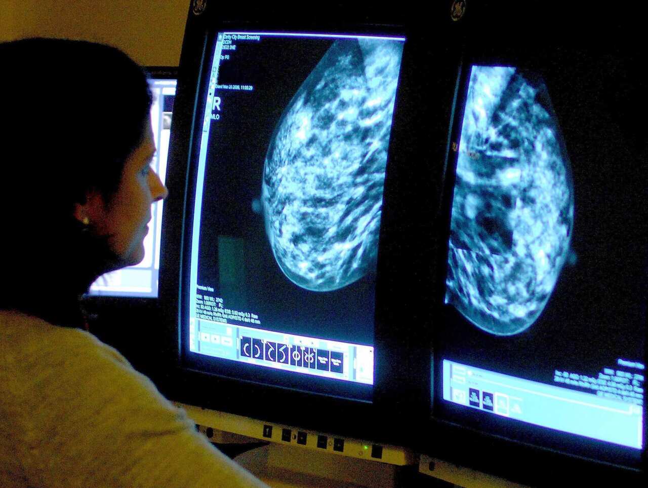 How obesity causes cancer, and may make screening and treatment harder