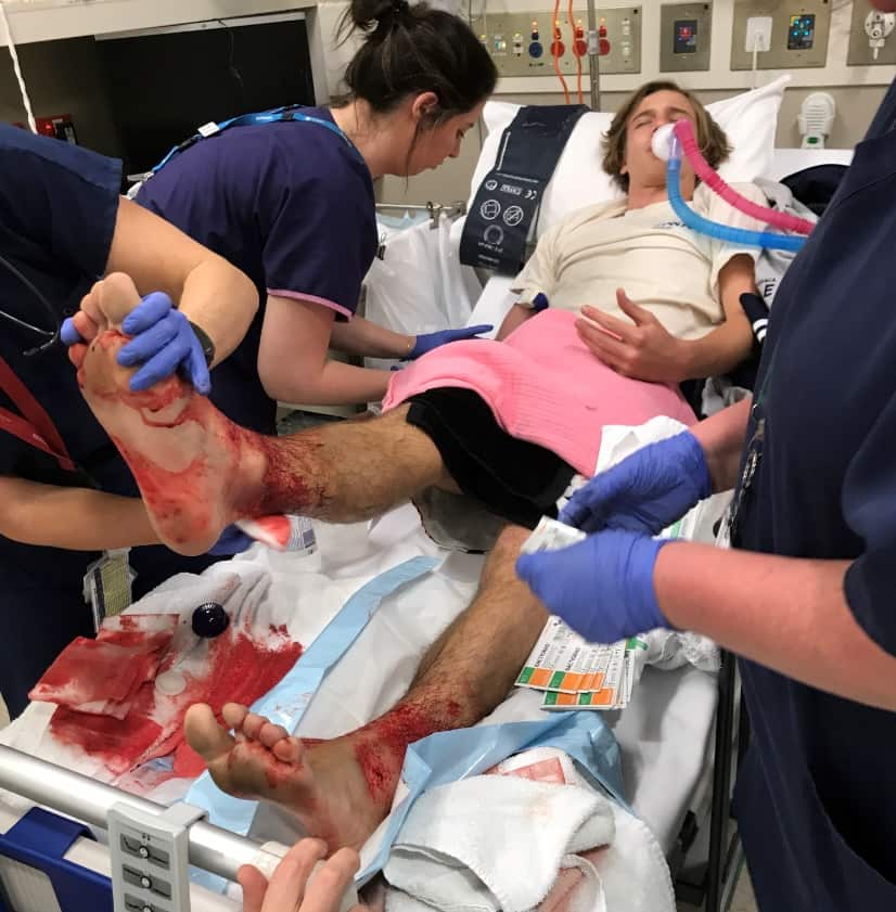 A supplied image obtained on August 6, 2017 of 16-year-old Sam Kanizay in a Melbourne Hospital after sustaining suspected bites from 'tiny marine creatures'