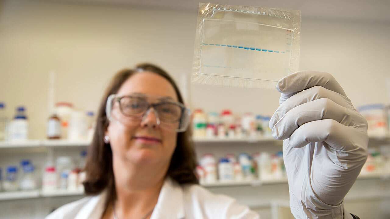 Head of allergy research at Queensland University of Technology, Professor Janet Davies.