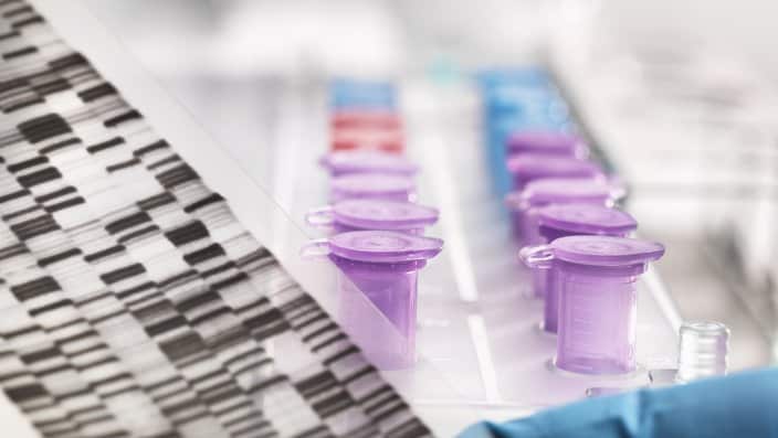 Scientist holding a DNA autoradiogram gel showing genetic information with samples in tray