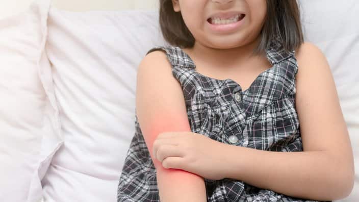 girl scratch the itch with hand