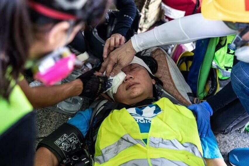 An indonesia reporter was shot in one eye and confirmed to be blind.