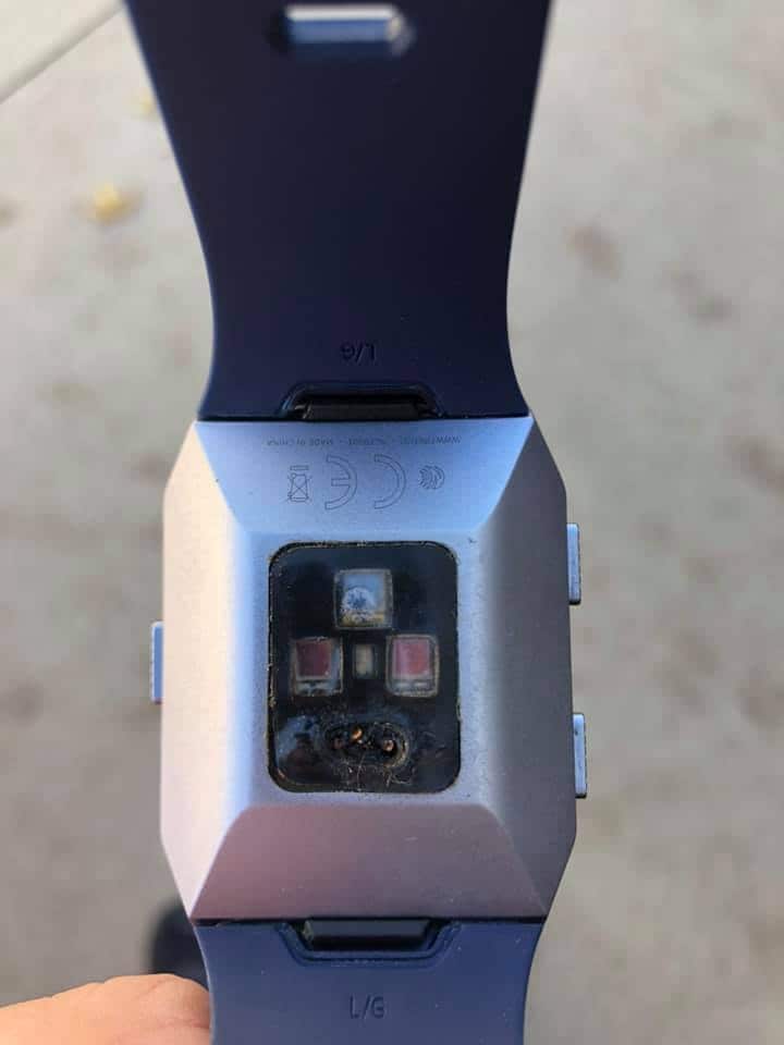 A man claims he sustained third-degree burns when his Fitbit exploded in his sleep